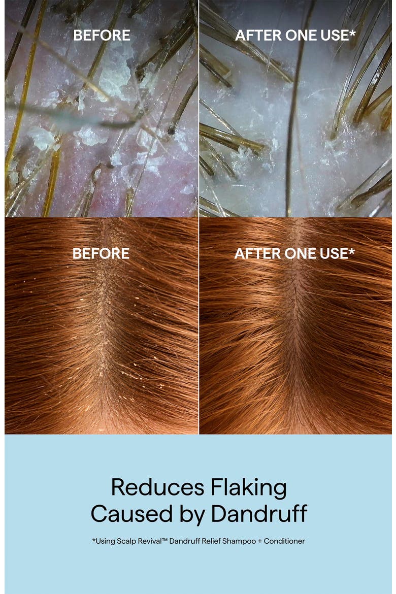 Scalp Revival™ Dandruff Relief Conditioner with Charcoal + Salicylic Acid, Alternate, color, NO COLOR