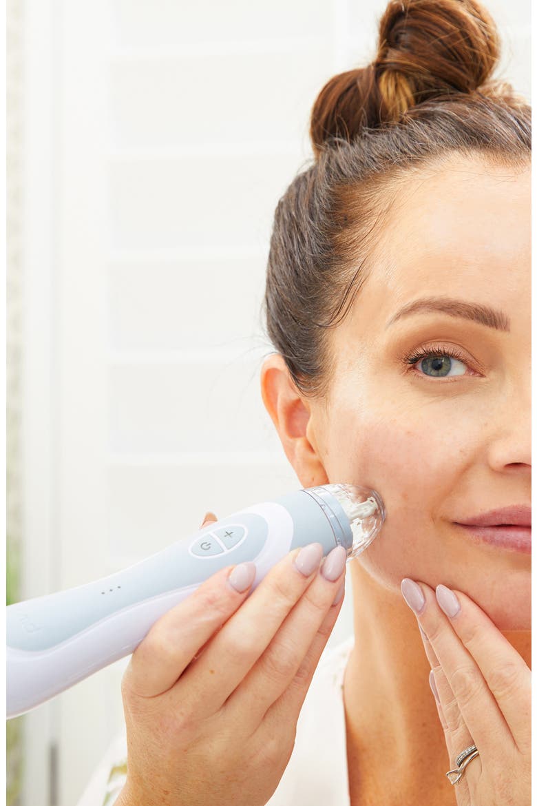 Personal Microderma Elite Pro Exfoliation Device, Alternate, color, LONDON FOG