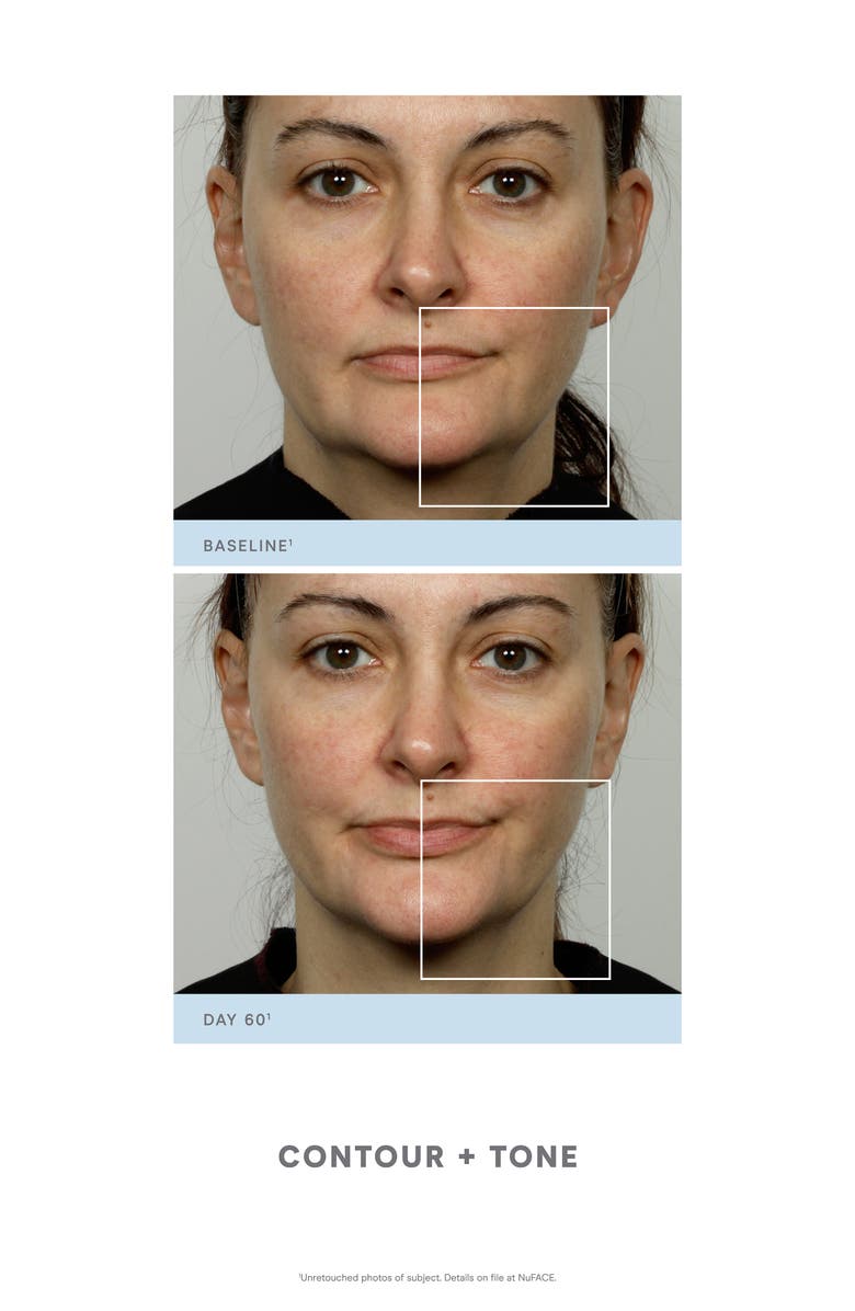 NuFACE<sup>®</sup> Trinity<sup>®</sup> Facial Toning Kit $339 Value, Alternate, color,