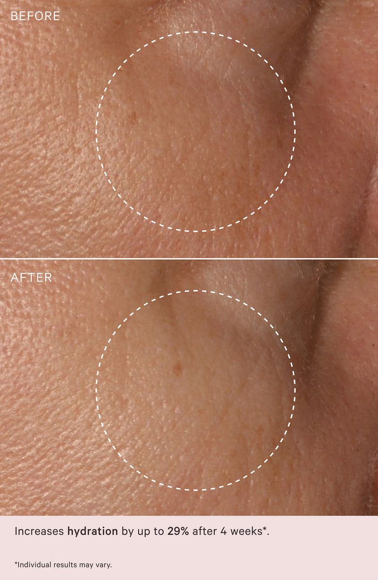 MZ Skin Hydrate & Nourish Age Defense Retinol Moisturizer SPF 30, Alternate, color, 