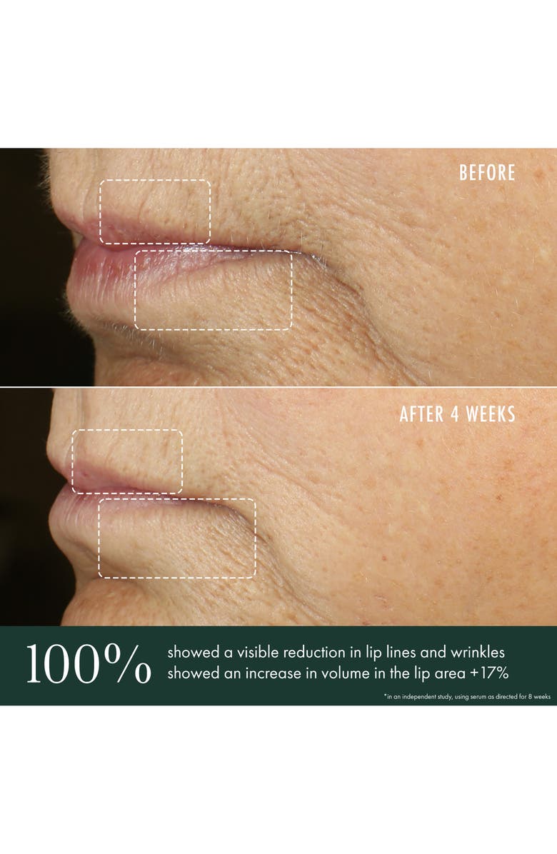 RéVive<sup>®</sup> Advanced Lip Perioral Serum Targeted Vertical Line Filler, Alternate, color,