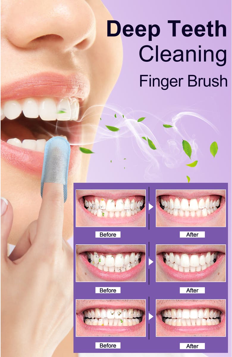 MySmile Teeth Wipes Disposal Finger Brush Deep Cleaning Teeth Wipes, Mint Flavor, Alternate, color, Purple