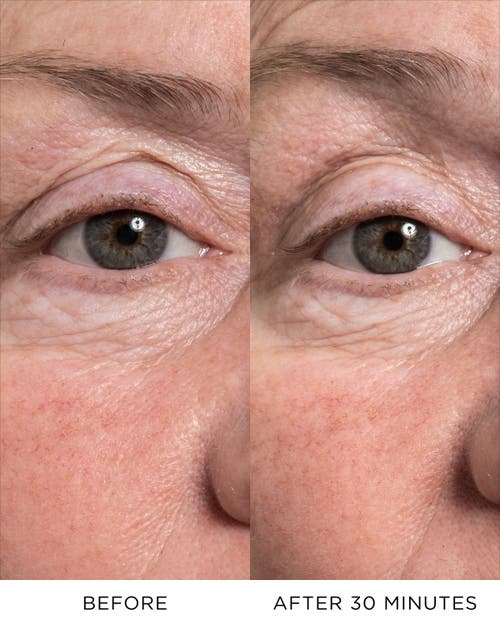 Noble Panacea The Eye Lift Concentrate In White