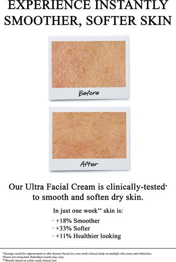 Ultra Facial Cream Hydrating Moisturizer