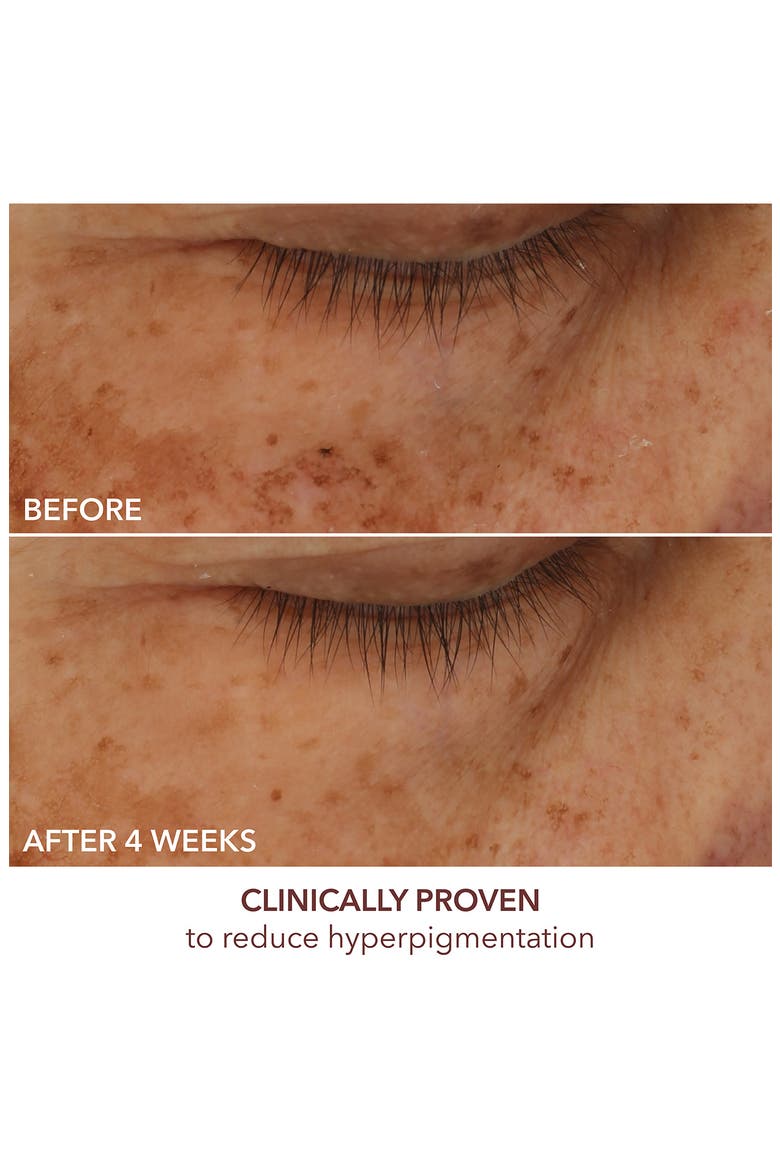 Advanced Retinol + Ferulic Overnight Texture Renewal Peel, Alternate, color, NO COLOR