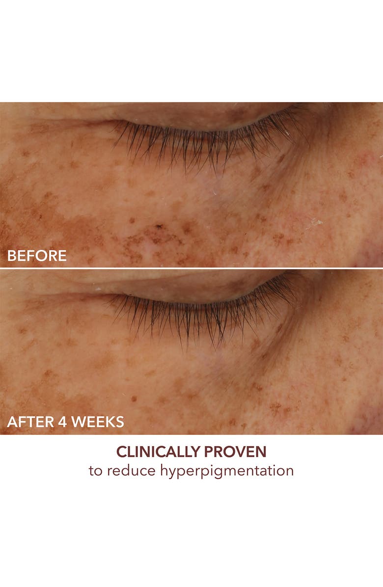 Dr. Dennis Gross Skincare Advanced Retinol + Ferulic Overnight Texture Renewal Peel, Alternate, color,