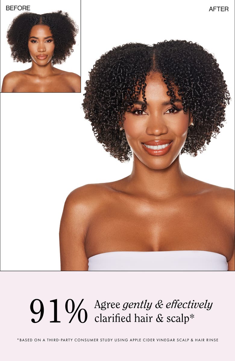 RIZOS CURLS Apple Cider Vinegar Scalp & Hair Rinse, Alternate, color,
