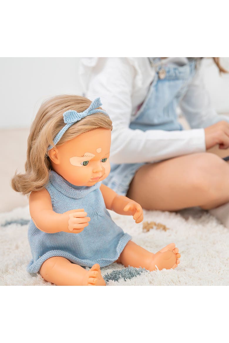 Baby Doll Caucasian Dirty Blonde Girl With Vitiligo 15'', Alternate, color, Light Skin