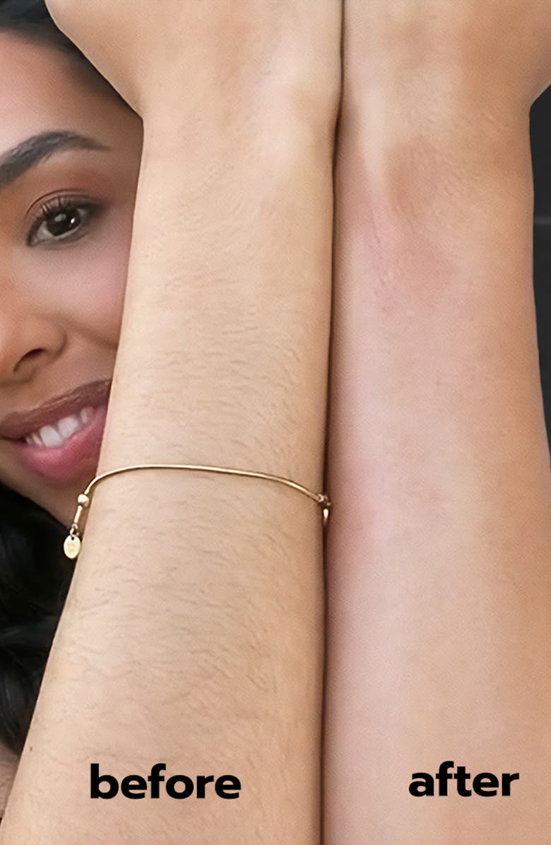 ANSWR Exfoliating Hair Removal Drop, Alternate, color, 