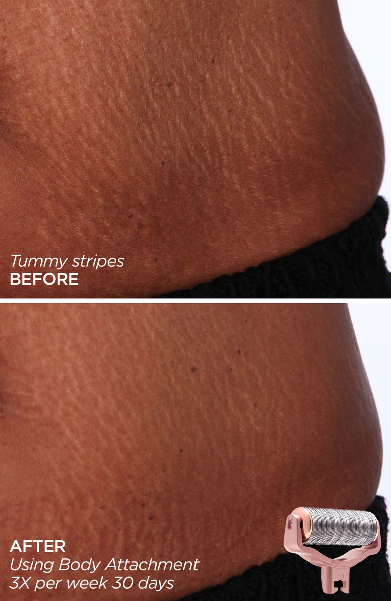 BeautyBio GloPRO<sup>®</sup> Skin That Glitters Set, Alternate, color, 