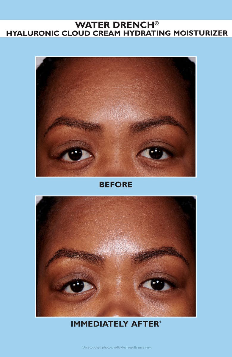 Peter Thomas Roth Clinically Stronger Hydration 2-Piece Set (Limited Edition) $58 Value, Alternate, color,