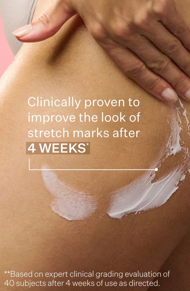 StriVectin<sup>®</sup> SD Advanced<sup>™</sup> Plus Intensive Moisturizer, Alternate, color, 