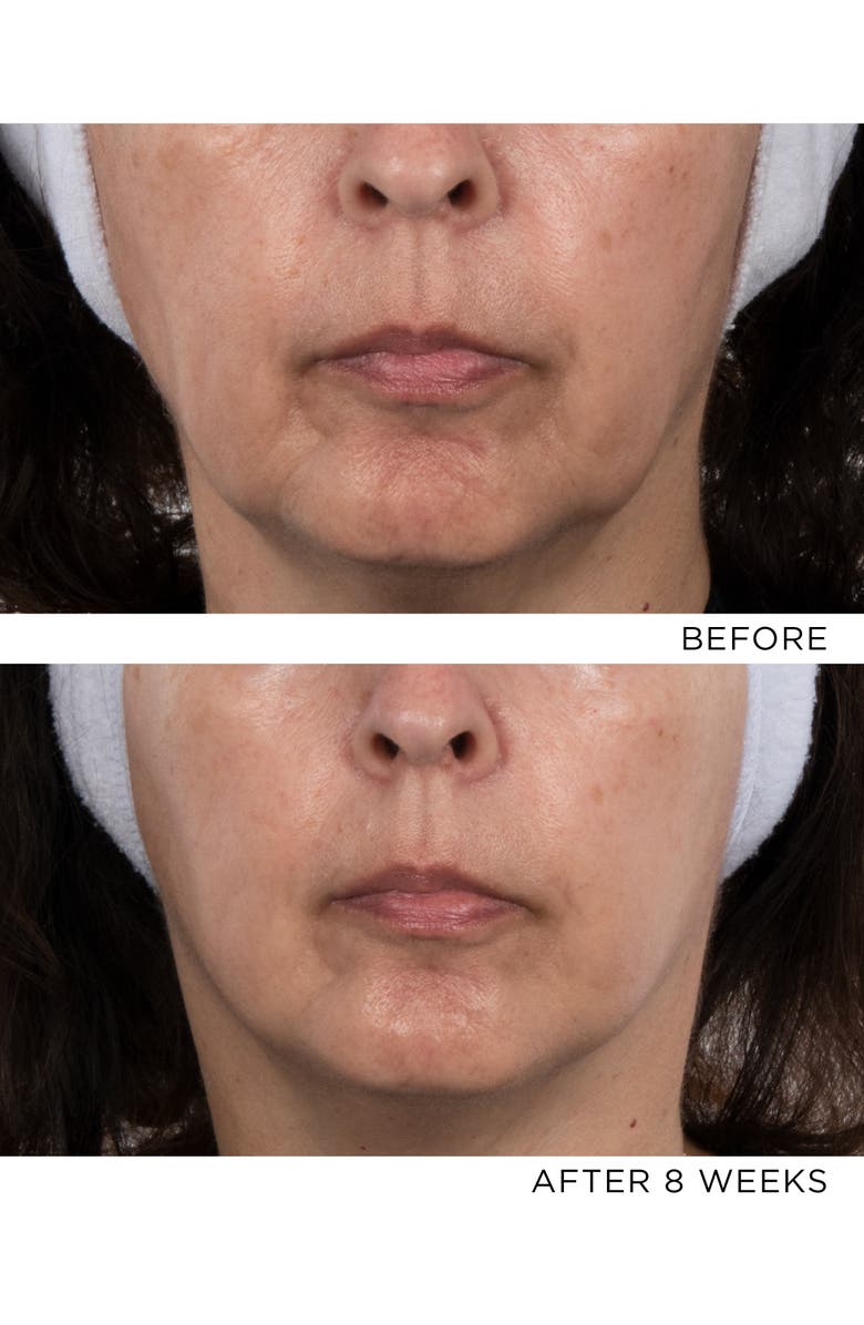 Noble Panacea The Exceptional Chronobiology Sleep Mask, Alternate, color, Refill