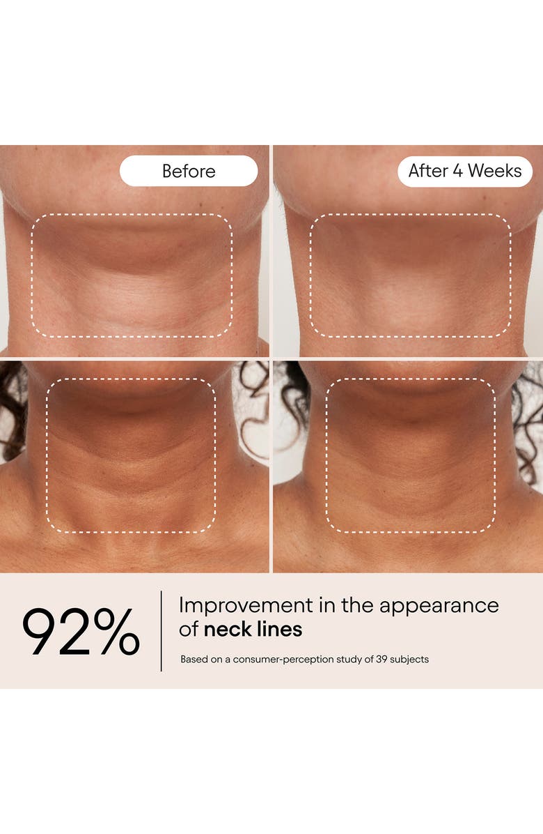 Alpyn Super Sculpt Serum for Face & Neck with Tri-Peptide Firming Complex, Alternate, color, 