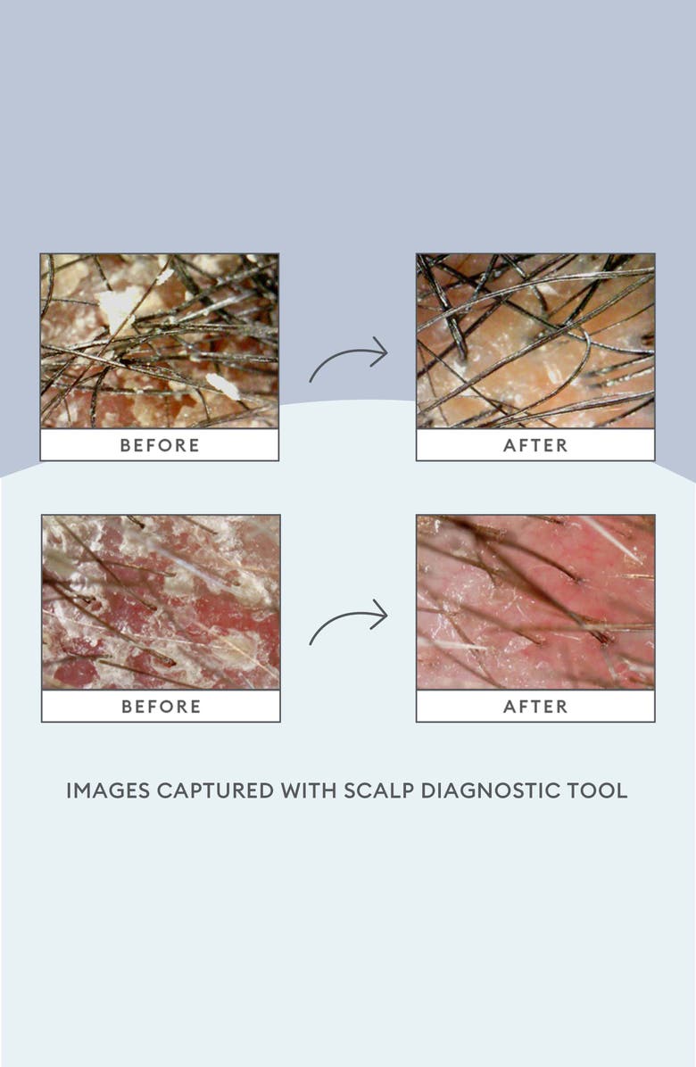 Briogeo Scalp Revival Kit $46 Value, Alternate, color, 