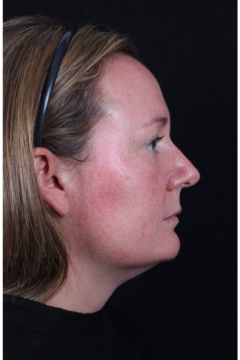 ® All Calm™ Clinical Redness Corrector SPF 50 PA++++, Alternate, color, NO COLOR