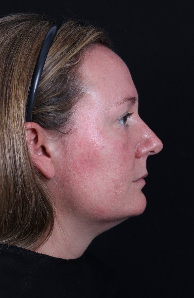 Colorescience <sup>®</sup> All Calm<sup>™</sup> Clinical Redness Corrector SPF 50 PA++++, Alternate, color,