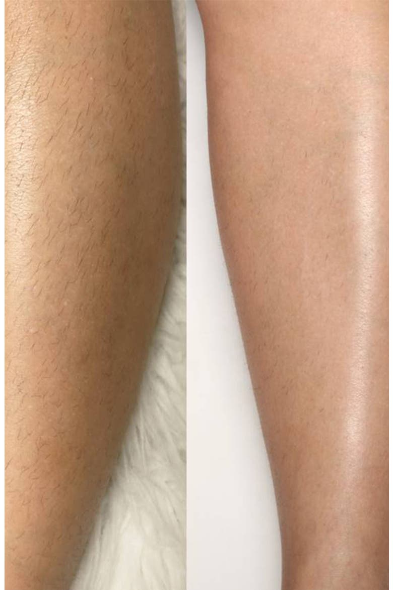 Flash&Go Jewel Hair Removal Device, Alternate, color, NO COLOR