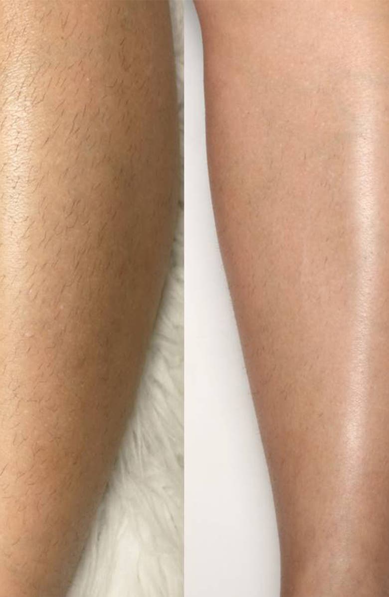 Silk'n Flash&Go Jewel Hair Removal Device, Alternate, color,