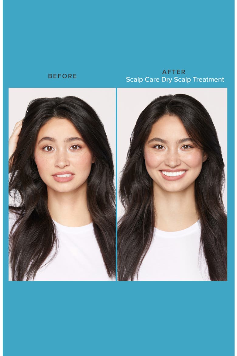 Scalp Care Dry Scalp Treatment, Alternate, color, NO COLOR