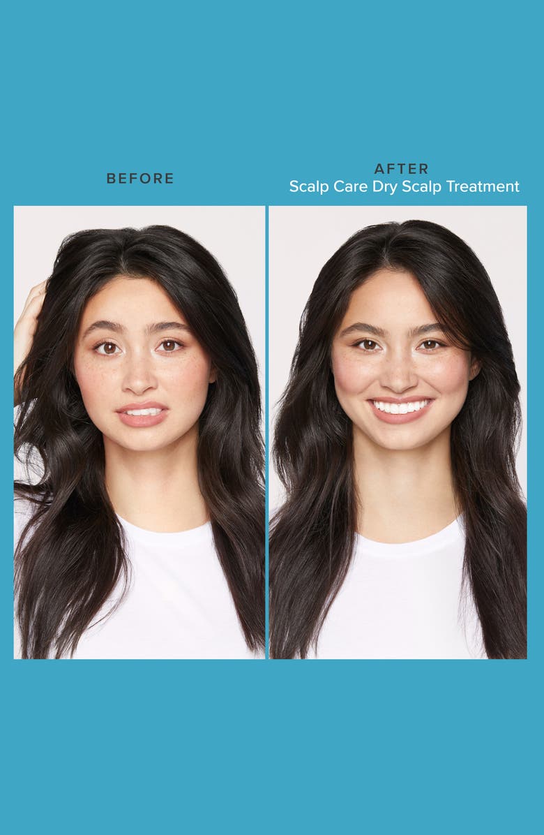 Living proof<sup>®</sup> Scalp Care Dry Scalp Treatment, Alternate, color,