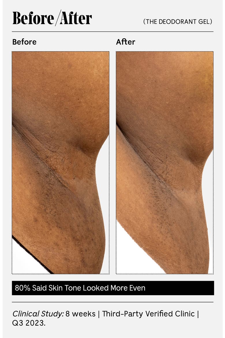 The Deodorant Gel, Alternate, color, FRAGRANCE FREE