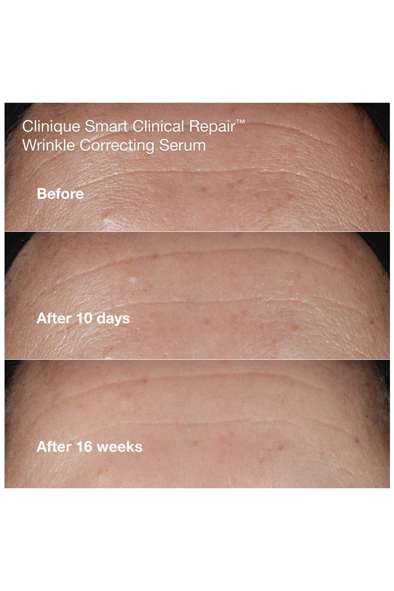 Smart Clinical Repair Anti-Aging Routine Skin Care Gift Set $124 Value, Alternate, color, NO COLOR