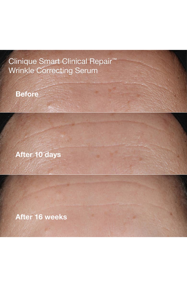 Clinique Smart Clinical Repair Anti-Aging Routine Skin Care Gift Set $124 Value, Alternate, color, 