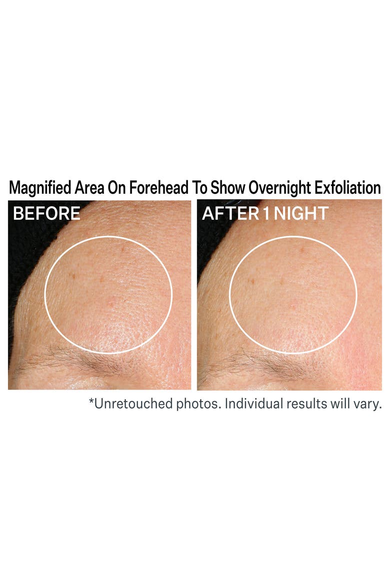 Advanced Hydration Lactic Acid Nightly Retexturizing Serum, Alternate, color, NO COLOR