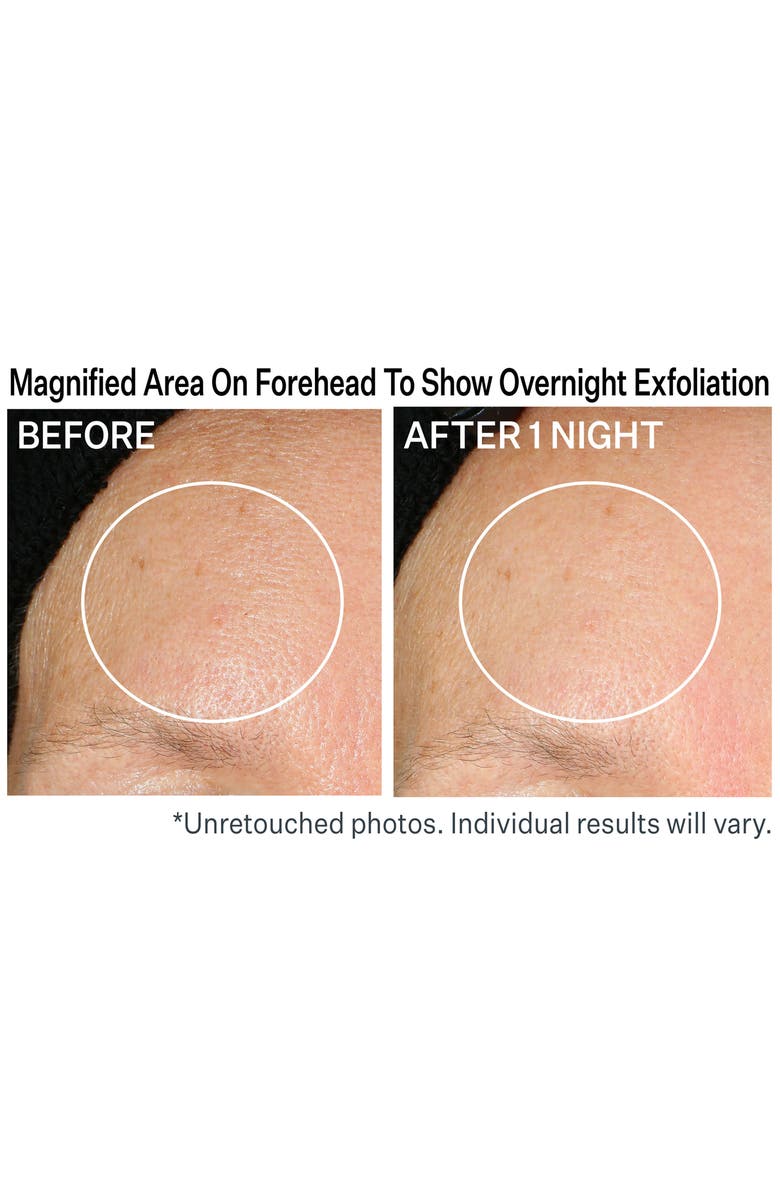 StriVectin<sup>®</sup> Advanced Hydration Lactic Acid Nightly Retexturizing Serum, Alternate, color,