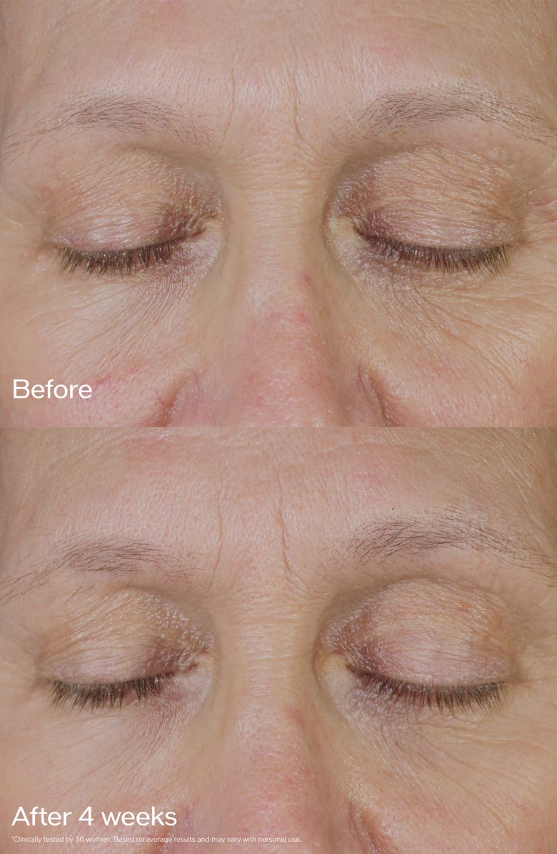 Shiseido Vital Perfection Uplifting and Firming Eye Cream, Alternate, color,