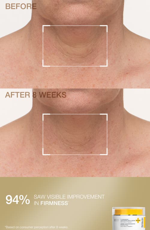 Strivectin ® Tighten & Smooth Skin Care Set In Transparent