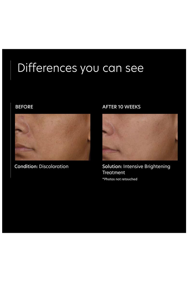 Intensive Brightening Treatment, Alternate, color, NO COLOR
