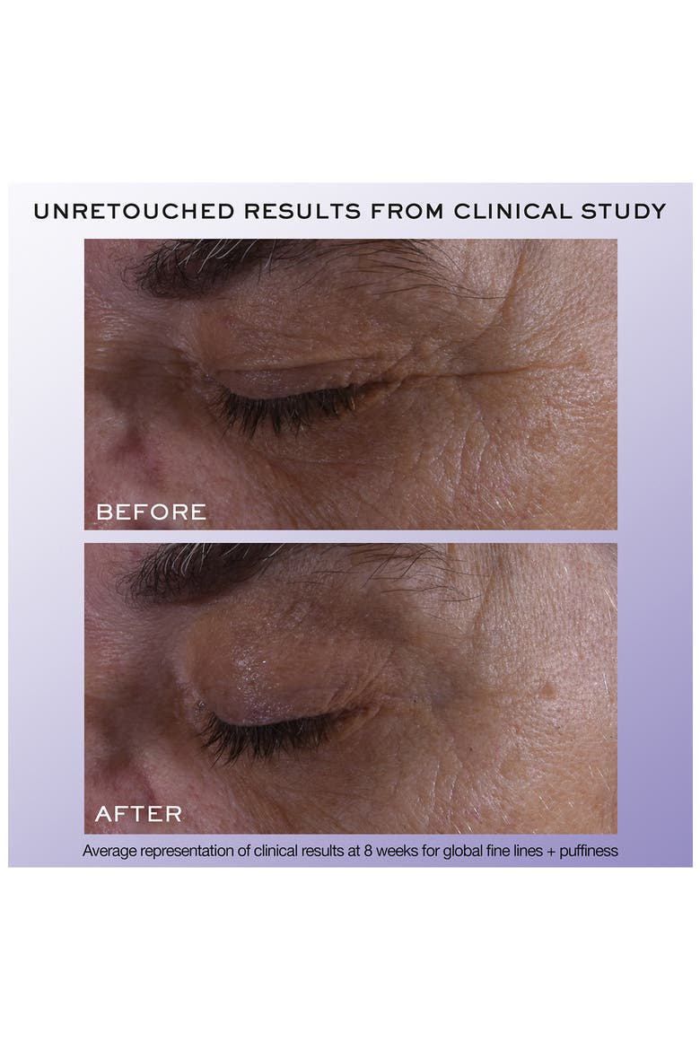 Rénergie H.C.F. Triple Eye Serum, Alternate, color, NO COLOR