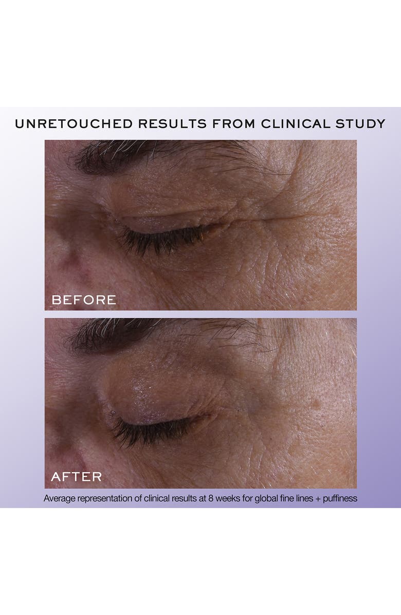 Lancôme Rénergie H.C.F. Triple Eye Serum, Alternate, color, 