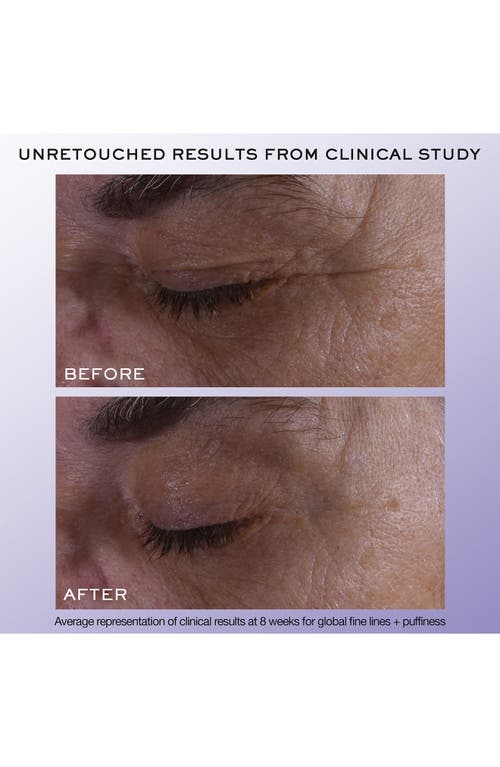 Lancôme Rénergie H.c.f. Triple Eye Serum In No Color