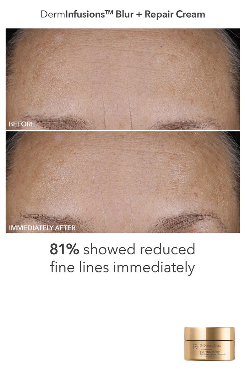 Dr. Dennis Gross Skincare Plump + Smooth Kit $50 Value, Alternate, color, 