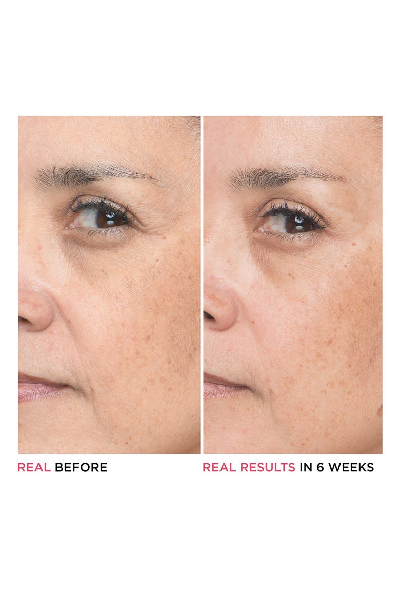 Bye Bye Lines Hyaluronic Acid Serum, Alternate, color, NO COLOR