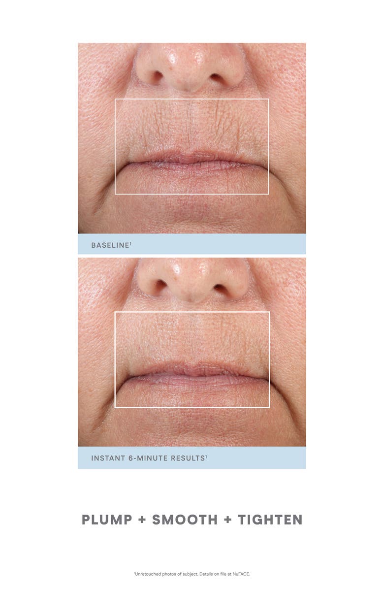 NuFACE<sup>®</sup> Petite Facial Kit-$358 Value, Alternate, color,