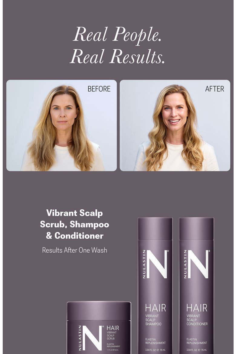 Vibrant Scalp Travel Kit, Alternate, color, White Brilliant