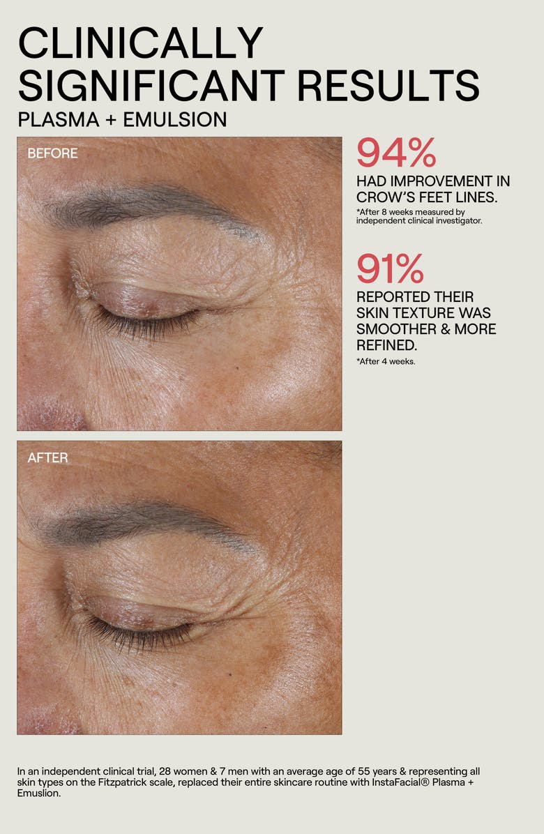 Dr. Diamond's Metacine Instafacial<sup>®</sup> Collection Trio Set, Alternate, color, 