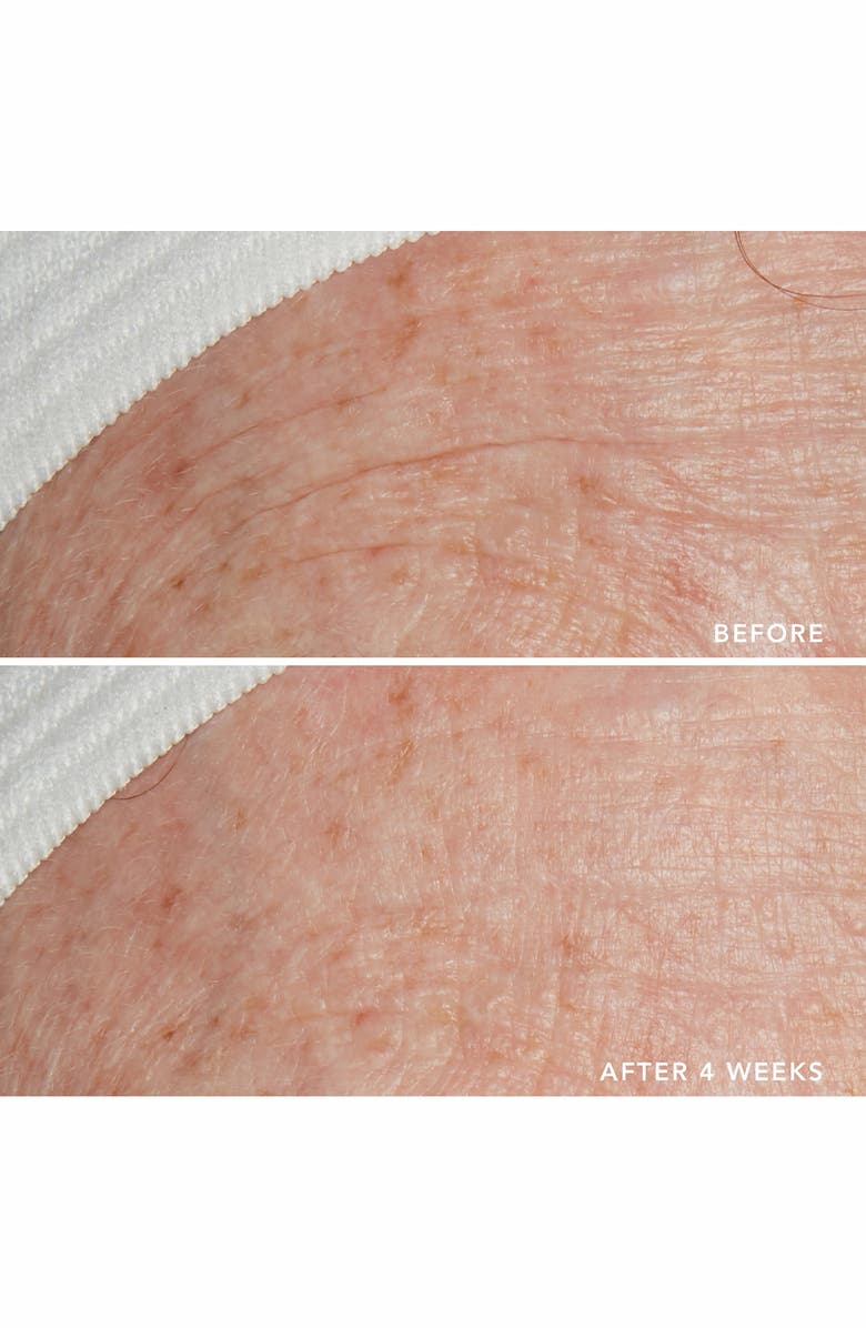 LANCER Skincare Triple Peptide Drops with Vitamin E + Niacinamide, Alternate, color, 