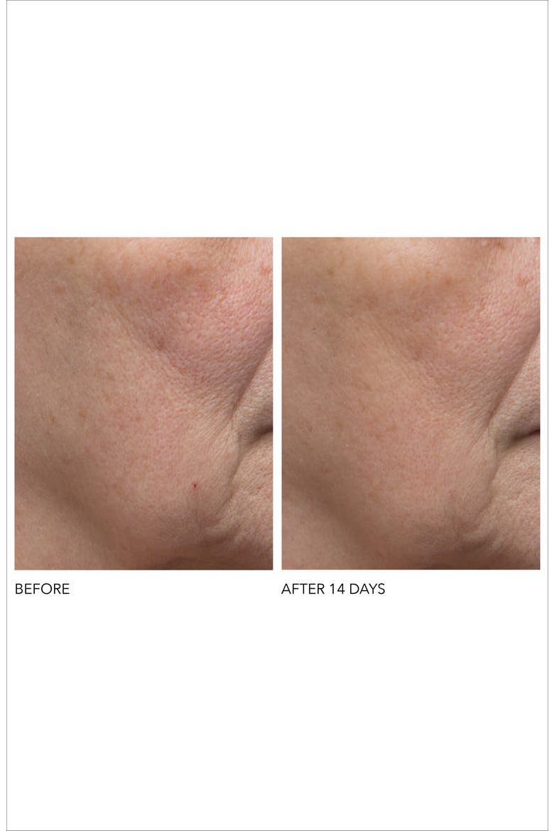 Alpha Beta® Exfoliating Moisturizer Cream, Alternate, color, NO COLOR