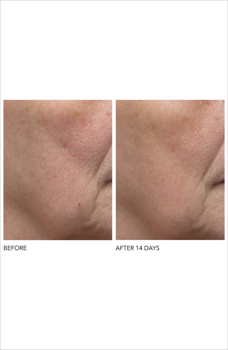 Dr. Dennis Gross Skincare Alpha Beta<sup>®</sup> Exfoliating Moisturizer Cream, Alternate, color,