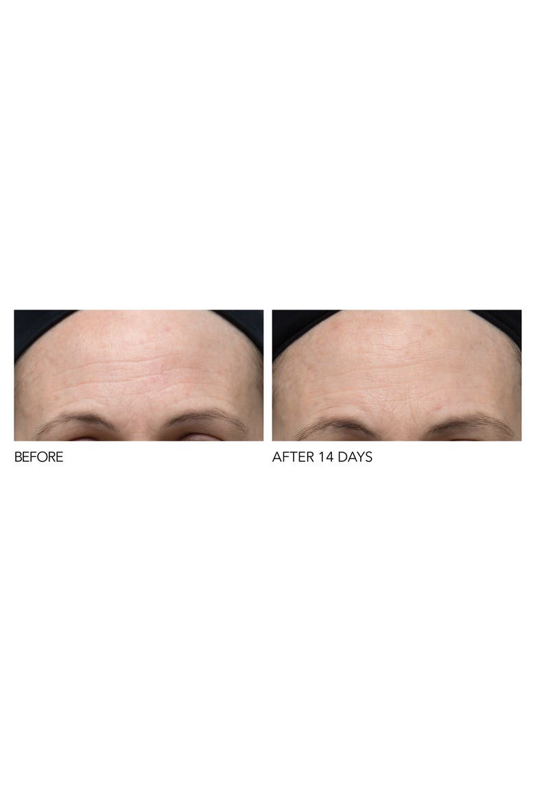 Iconic Radiance Alpha Beta® Extra Strength Daily Peel, Alternate, color, NO COLOR