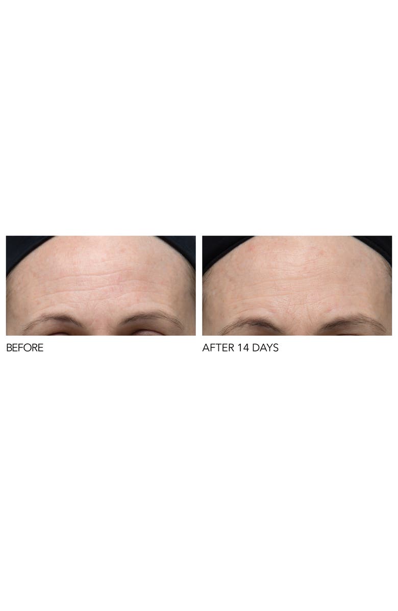 Dr. Dennis Gross Skincare Iconic Radiance Alpha Beta<sup>®</sup> Extra Strength Daily Peel, Alternate, color, 