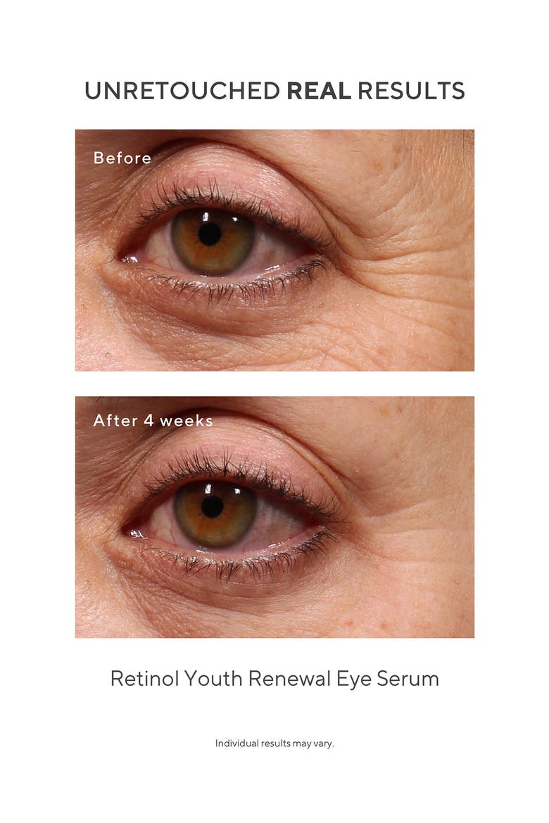 Under the Microscope: The Retinol Renewers Set (Limited Edition) $164 Value, Alternate, color, NO COLOR