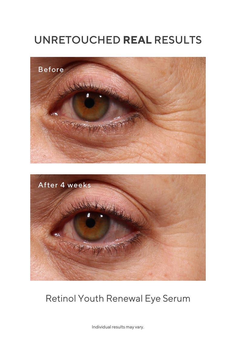 Murad<sup>®</sup> Under the Microscope: The Retinol Renewers Set (Limited Edition) $164 Value, Alternate, color,