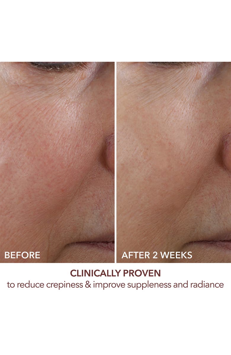 Dr. Dennis Gross Skincare Advanced Retinol + Ferulic Overnight Wrinkle Treatment, Alternate, color,