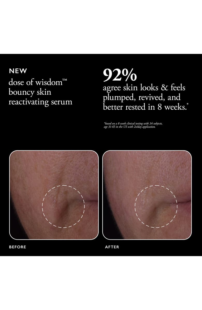 philosophy dose of wisdom<sup>™</sup> bouncy skin reactivating serum, Alternate, color,